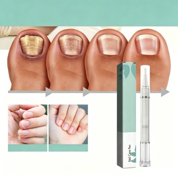 4x NAIL CARE PEN — ручка-фломастер, СТИК ДЛЯ УХОДА ЗА НОГТЯМИ, 4 мл