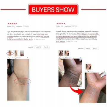 Отбеливающий крем для удаления меланина и осветления кожи