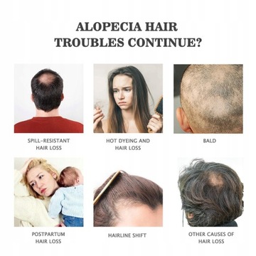 Сыворотка для роста волос с эфирным маслом имбиря