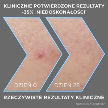 Garnier Pure Active Сыворотка для лица против AHA BHA кислот и карбона 30 мл