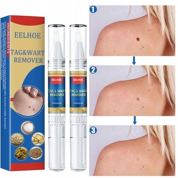 Tag & Wart Remover Anti Remedy Learty Pen Pen