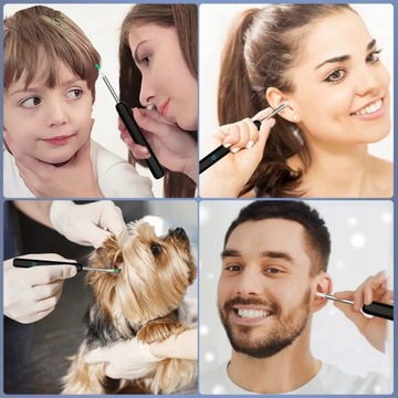 УМНАЯ ОТОСКОПНАЯ КАМЕРА ВОСК ДЛЯ ЧИСТКИ УШЕЙ WIFI HD ПРИЛОЖЕНИЕ ЭНДОСКОП CE