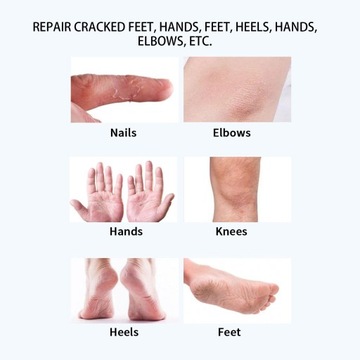 LANTHOME Крем с мочевиной и кислотой для удаления мозолей ног 50 мл