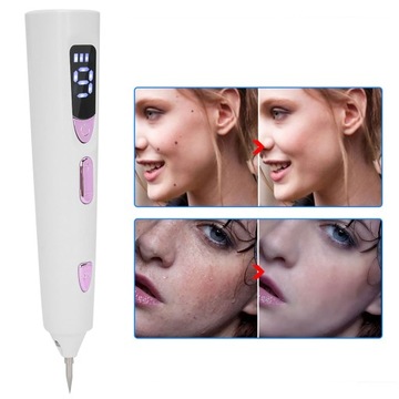 Удаление родинок Средство для удаления темных пятен