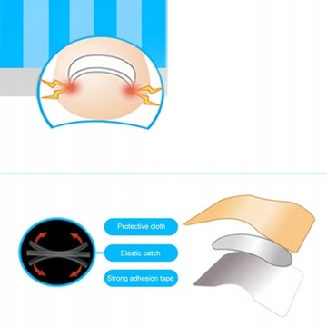 ПАТЧИ ДЛЯ ВРАСТЫВАЮЩИХ НОГТЕЙ ПАТЧИ 120 ШТ.