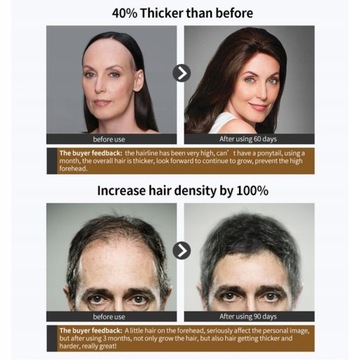 OUHOE Мощная сыворотка-спрей для роста волос