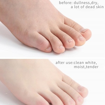 Спрей для пилинга ног с эссенцией для педикюра для рук