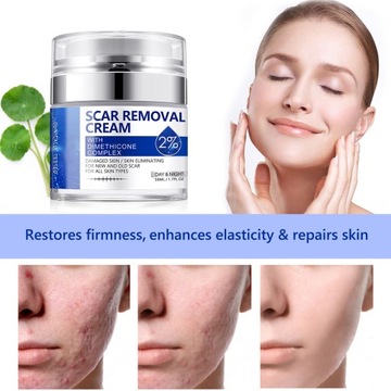 Scar Removal Cream 50ml Scar Lightening Repair