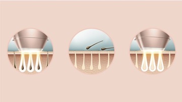 PHILIPS LUMEA IPL 7000 ДЕПИЛЯТОР ДЛЯ ТЕЛА, ЛИЦА БИКИНИ 2 ВНИМАНИЯ + ТРИМЕР