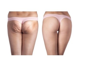 Китайские силиконовые чашки для массажа тела и лица