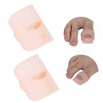 КОРРЕКЦИЯ ВРАСТНЫХ НОГТЕЙ СИЛИКОНОМ 3*2СМ