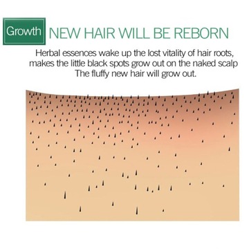 Имбирный лак для волос, питающий волосы