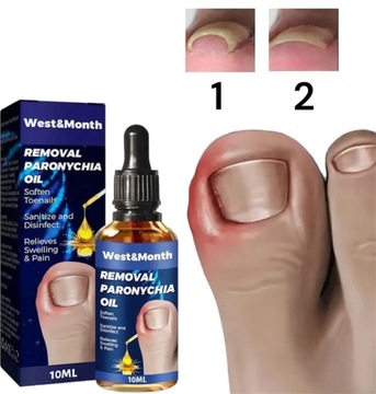 ЖИДКОСТЬ ДЛЯ ВРАСТАНИЯ НОГТЕЙ ОТ БОЛИ В НОГТЯХ