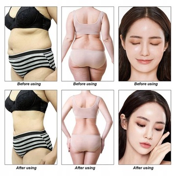 КАВИТАЦИОННАЯ УЛЬТРАЗВУКОВАЯ ЛИПОСАКЦИЯ RF 9 В 1