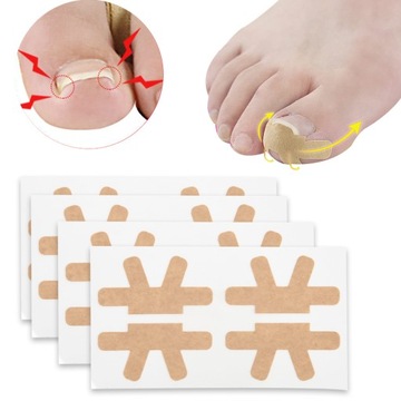 НАШИВКИ ДЛЯ ВРАСТНЫХ НОГТЕЙ 4ШТ PLAST