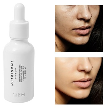 SERUM PEELING KWASOWY do twarzy AHA i BHA NIE PODRAŻNIA serum peeleingujące