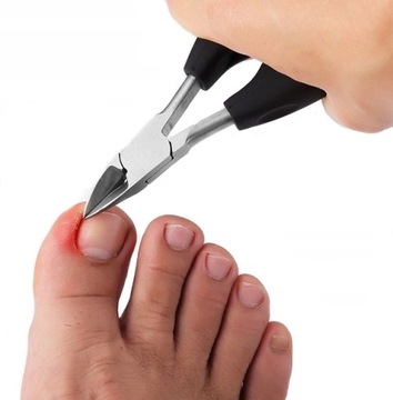 ЩИПЦЫ ЩИПЦЫ ДЛЯ ВРАСТНЫХ НОГТЕЙ