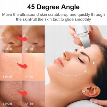 Ультразвуковой скруббер для кожи, глубокая кавитация и очистка