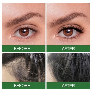 Эффект розмарина ускоряет рост волос