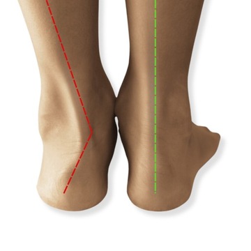 СТЕЛКИ ДЛЯ ОБУВИ ДЛЯ ЦЕНЫ И ПЛОСКОСТОЯНИЯ - МУЖСКАЯ СУПИНАЦИЯ