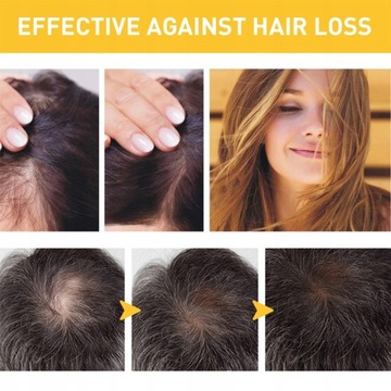 Крем для роста волос с имбирем, лечение выпадения волос