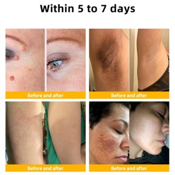 Корректирующий крем с пчелиным ядом, увлажняющий увлажняющий крем, удаление пятен