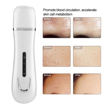 Ultradźwiękowy peeling do skóry twarzy Usuwanie