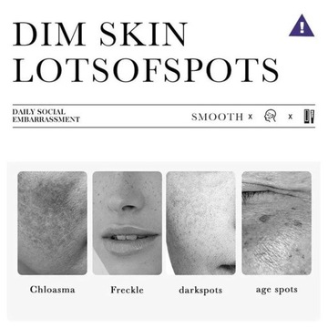 Skuteczny wybielający krem do piegów usuń Melasma ciemny krem do