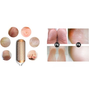 PROFESJONALNY PILNIK DO STÓP|USUWANIE ZROGOWACIAŁEJ SKÓRY| STAL NIERDZEWNA