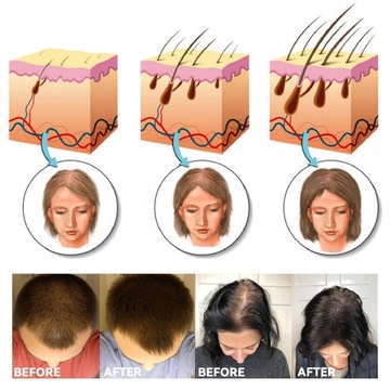 Имбирный порошок для роста волос, быстрое продвижение волос G