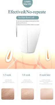 Профессиональный электрический эпилятор для волос с лазером IPL, удаление волос с точкой замерзания