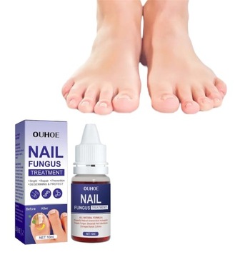 Грибок ногтей Strong Nail Repair Liquid