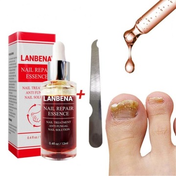LANBENA Fungal Nail Repair Essence Serum Care