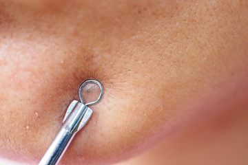 Łyżeczki Usuwania Wągrów Zaskórników Pryszczy 7szt