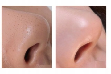 GREEN TEA MASK STICK ОЧИЩАЮЩАЯ МАСКА BLACKBLOCK + ПОМАДА АЛОЭ ВЕРА 99%