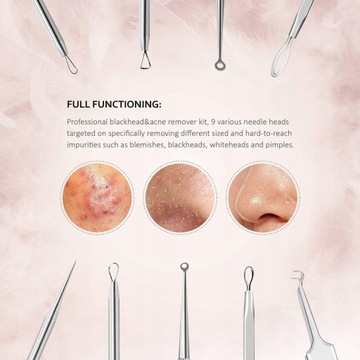 НАБОР ЛОЖЕК UNA ДЛЯ УДАЛЕНИЯ БЛЭКХОТОВ