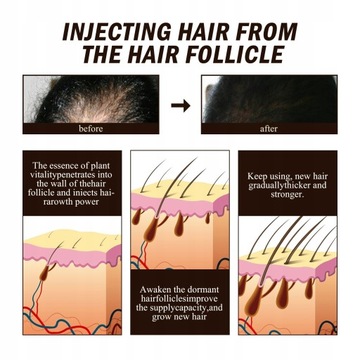 OUHOE Мощная сыворотка-спрей для роста волос