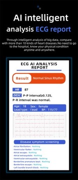 Умные часы Bluetooth-браслет