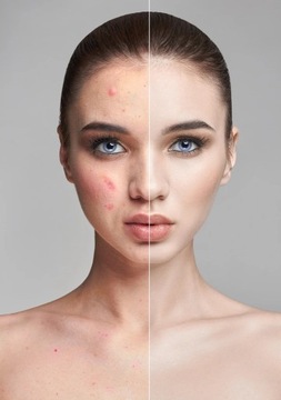 Ультразвуковой массажер для лица EMS Радиомезотерапия 6в1