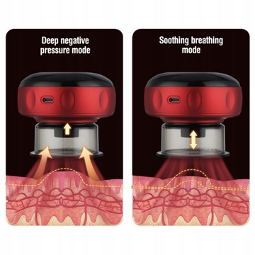 КИТАЙСКИЙ БАНКОВЫЙ ЭЛЕКТРОМАГНИТОТЕРАПИЯ-МАССАЖ