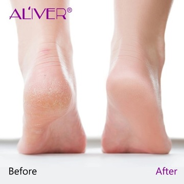 Aliver Lavender Heel Repair Balm - Бальзам для потрескавшихся пяток с лавандой 70г