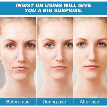 3 шт. Glamory микроинфузионная система для губ, Glamory микросистема для лица