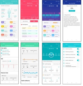 Умные часы AMOLED Часы Монитор артериального давления ЭКГ Глюкоза HRV