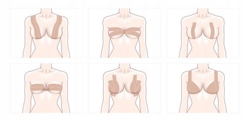 BOOBSUP ОРИГИНАЛЬНАЯ ЛЕНТА ДЛЯ ФОРМИРОВАНИЯ ГРУДИ ТЕЙПИРОВАНИЕ ГРУДИ