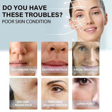 Коллагеновые абсорбирующие лифтинговые нити против морщин