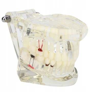 Przezroczysta choroba Model zębów laboratorium