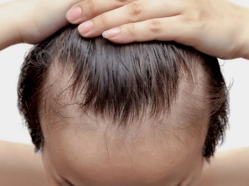 ДЕРМА РОЛИК для волос для роста волос уменьшает облысение кожи головы