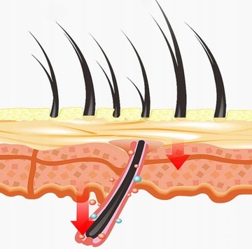Harvelis 28g - Утолщение микроволокон, маскирующее облысение редких волос