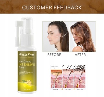 Спрей против выпадения волос «Имбирь» для роста волос