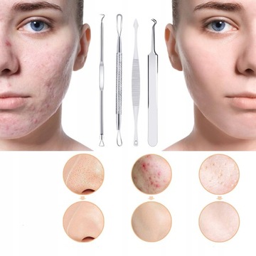 Набор для удаления черных точек, ложки UNY Pimples Wągrów, двусторонние, 8 шт.